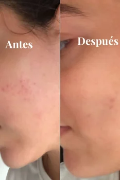 Salad Code Cosmética Facial><noscript><img width=